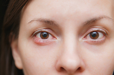 Professional Optometry Vision Care | Dry Eye, Learning Exams and Myopia